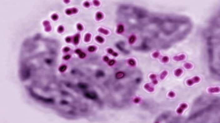 Neisseria Gonorrhoeae