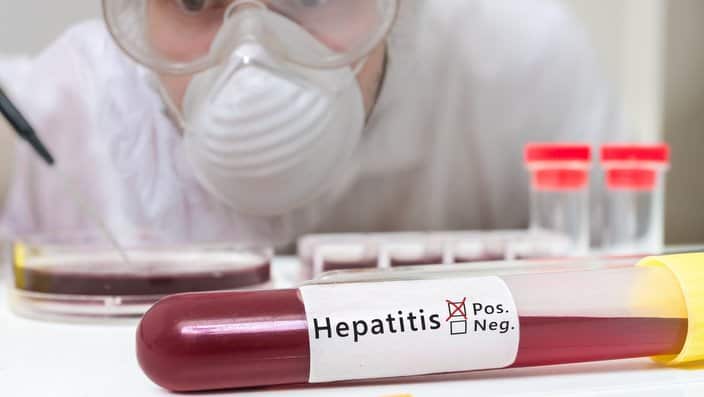 Test tube with blood for Hepatitis test
