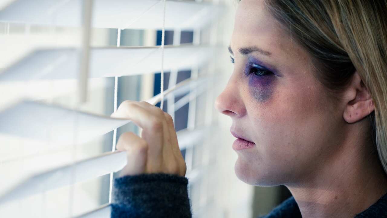 Woman with bruised eye