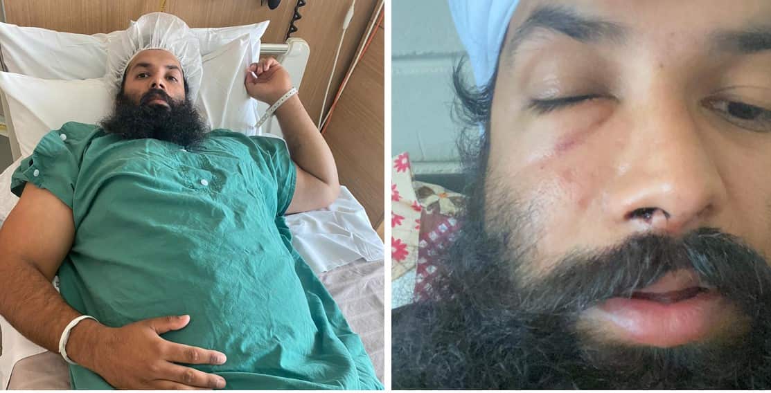 Gurinder Singh sustained facial injuries following the attack.