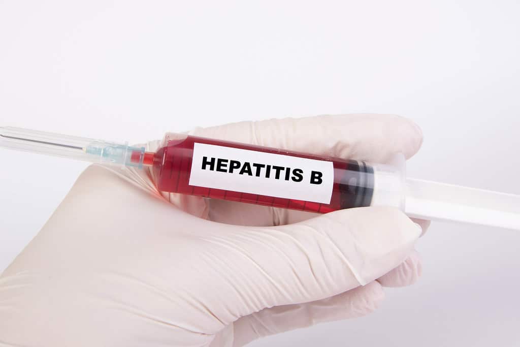 Syringe with Hepatitis B label - Source wuestinigel /Creative Commons.