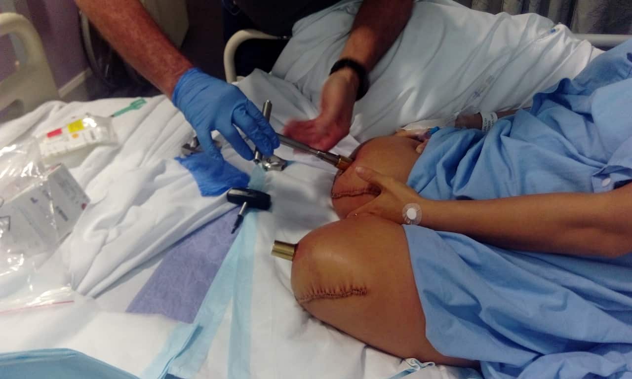 Lisa Calan receives surgical implants
