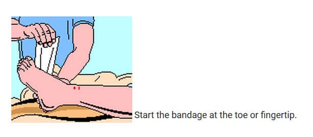 Pressure Immobilisation