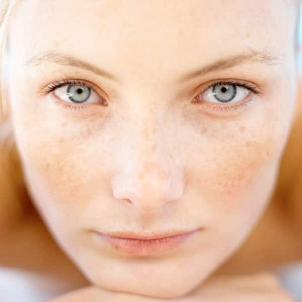 Pigmentation pregnancy