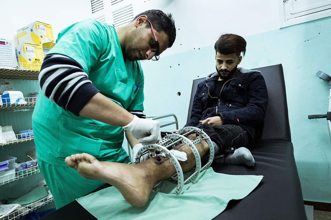 GAZA. 3rd March 2020. Nasser Kheel has his Ilizarov apparatus and wound cleaned at the MSF Clinic in Gaza
