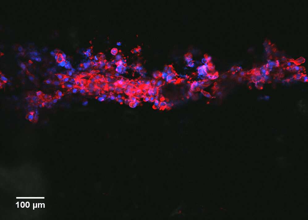 تصویری که نشان می دهد که سلول های عصبی در یک خط در امتداد جوهر رسانا رشد می کنند.