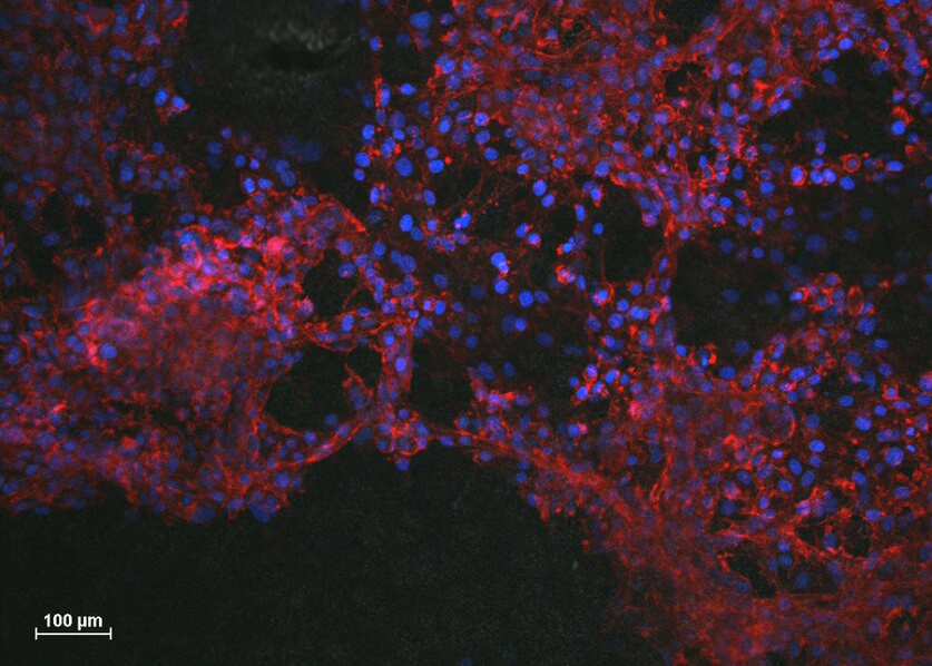 تصویری که نشان می دهد که سلول های عصبی در نبود جوهر رسانا در جهات مختلف رشد می کنند.