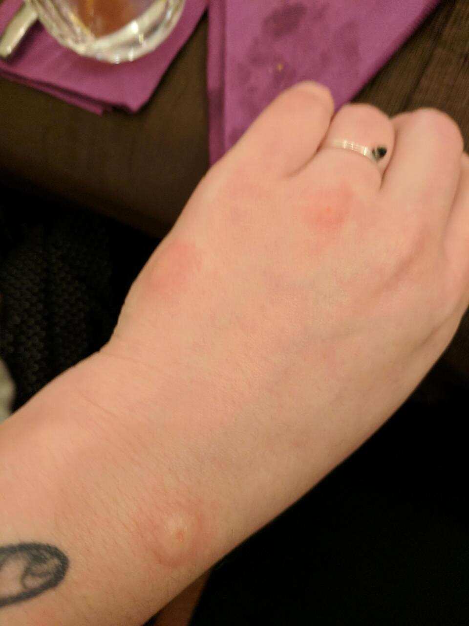 The family said they just wanted a plane without bugs to continue their holiday