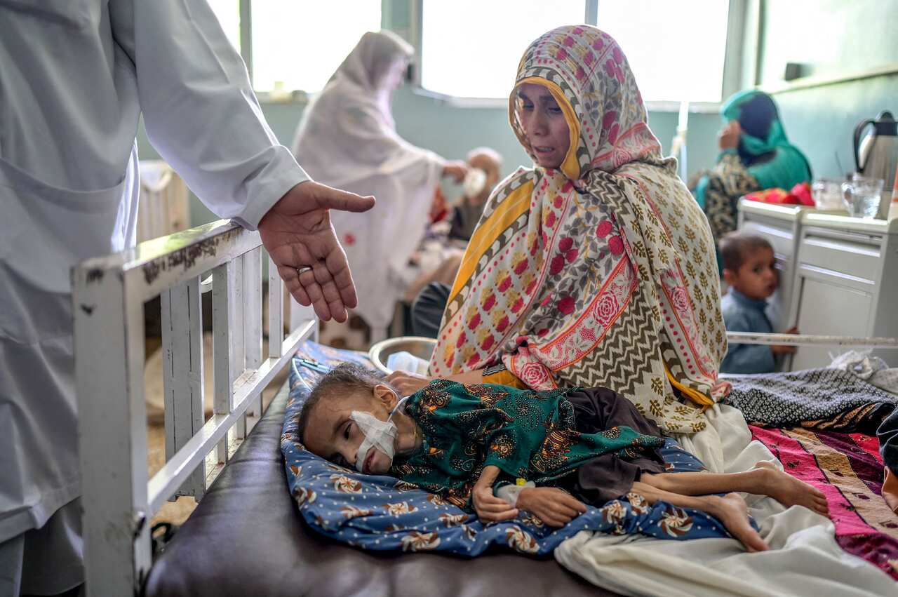 A child suffering from malnutrition receives treatment at the Mirwais hospital in Kandahar.