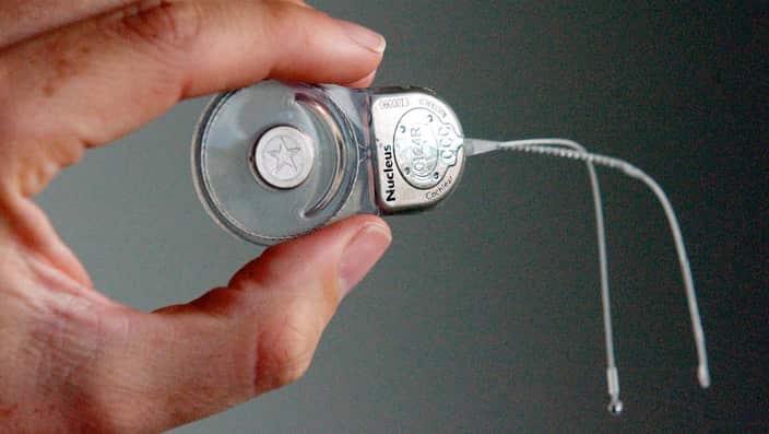 An April 23, 2002 file photo of a Cochlear implant which is inserted into the ear of a deaf patient, Sydney. Cochlear are celebrating the 30th anniversary of their first implant back in 1982.(AAP Image/Dan Peled) NO ARCHIVING