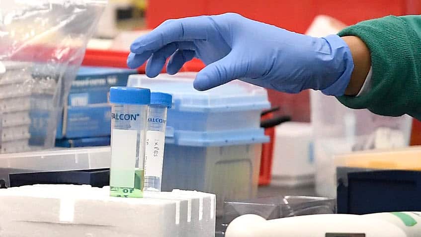 التأثير الايجابي لوباء كورونا على جهود مكافحة الزهايمر والملاريا وتقنيات الكشف عن السرطان