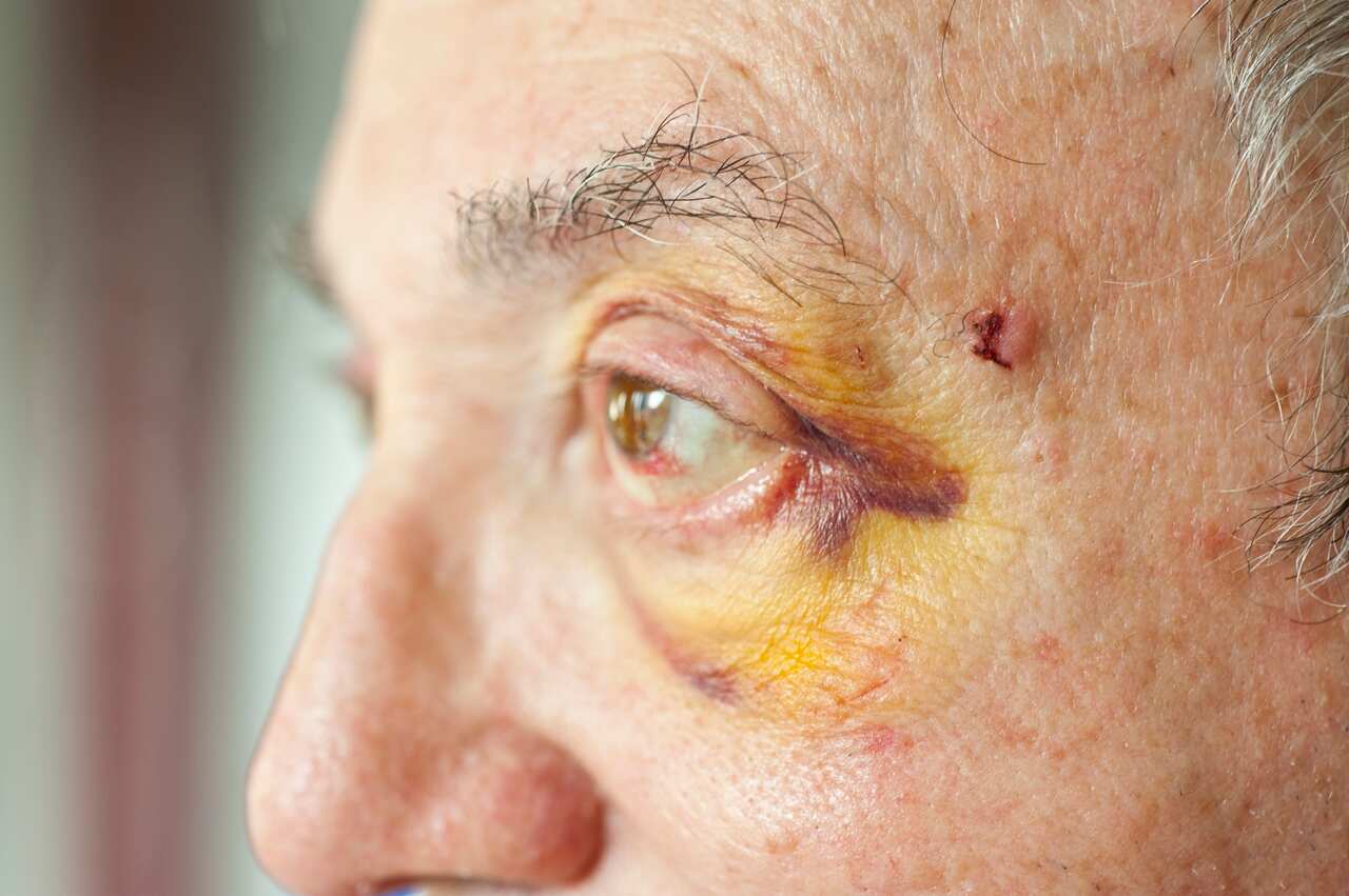 Elder abuse appears to be on the rise during the pandemic