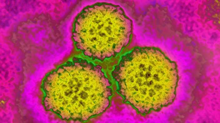 Papilloma virus (HPV)