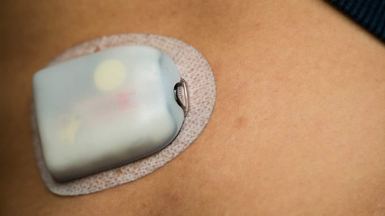 insulin pump