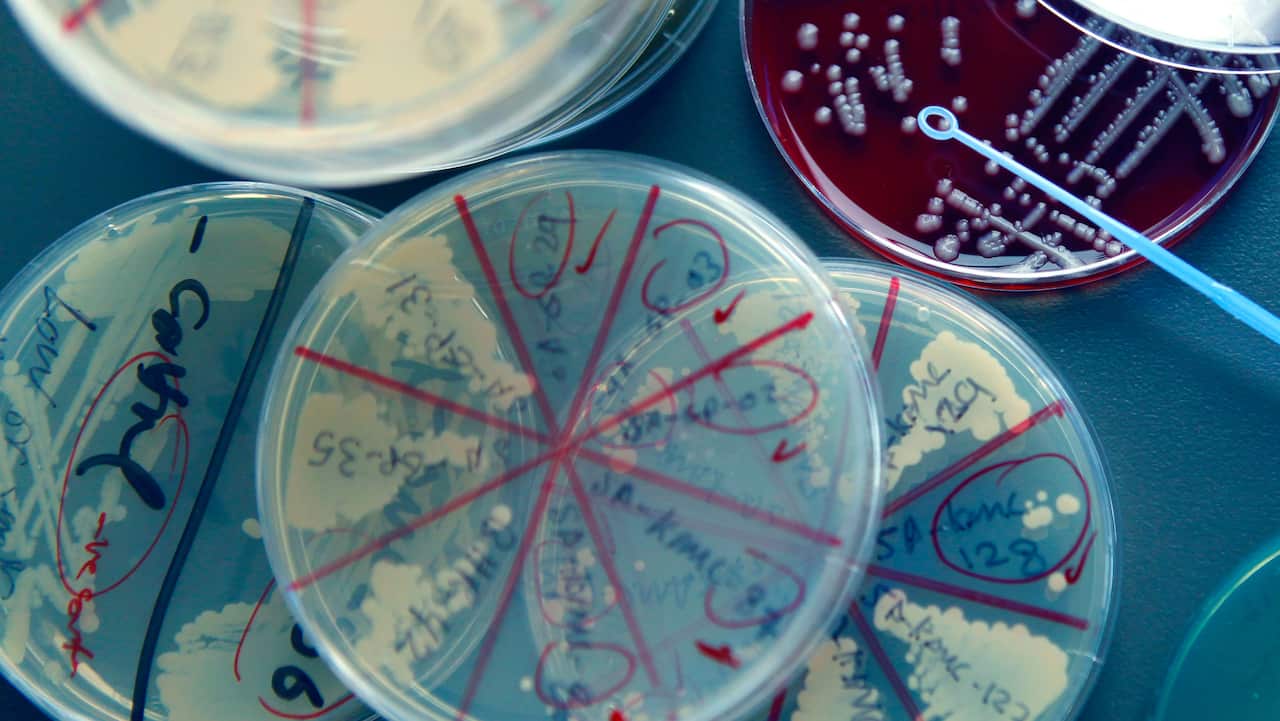 Petri dishes containing a multitude of Super Bugs inside the UQ Paterson Lab