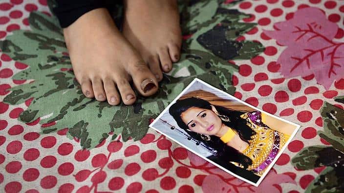 A file photo of Reshma before the attack lies at her feet as she rests in her home at a slum in the eastern suburbs of Mumbai in 2014 (Getty)