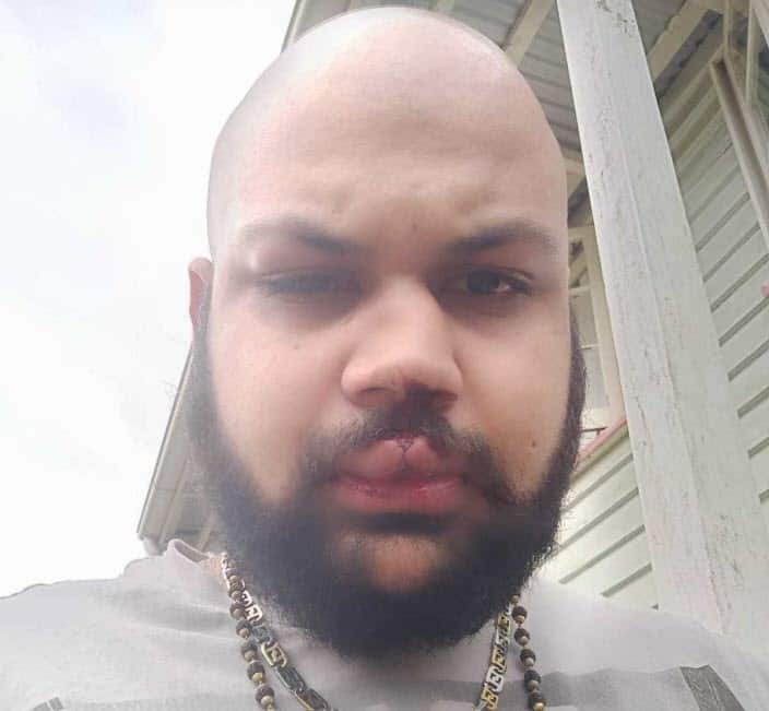 Racial attack brosbane