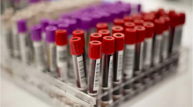 Potential blood donors are rigorously screened.