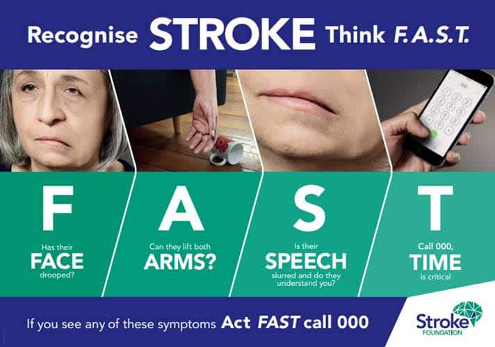 Stroke FAST Signs