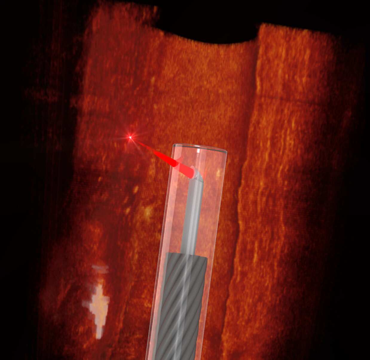 Ultrathin 3D printed endoscope imaging an artery