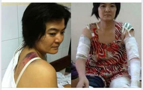 Trần Thị Nga tố cáo mình bị công an chặn đánh trọng thương