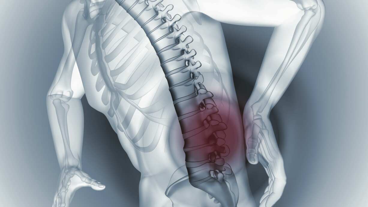 Perda óssea: mais um dano colateral da COVID-19