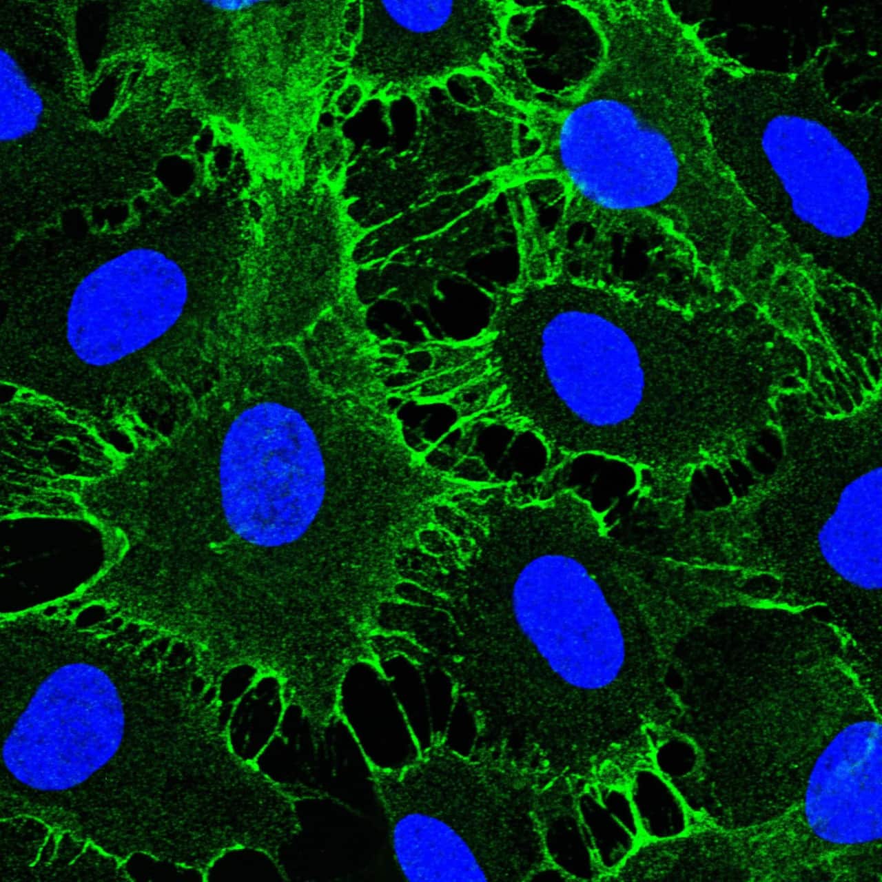 Andreas Pannek Zellforschung Uni Melbourne Doktortitel
