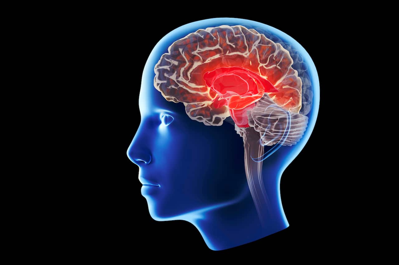 Alzheimer's disease affecting the hippocampus, illustration