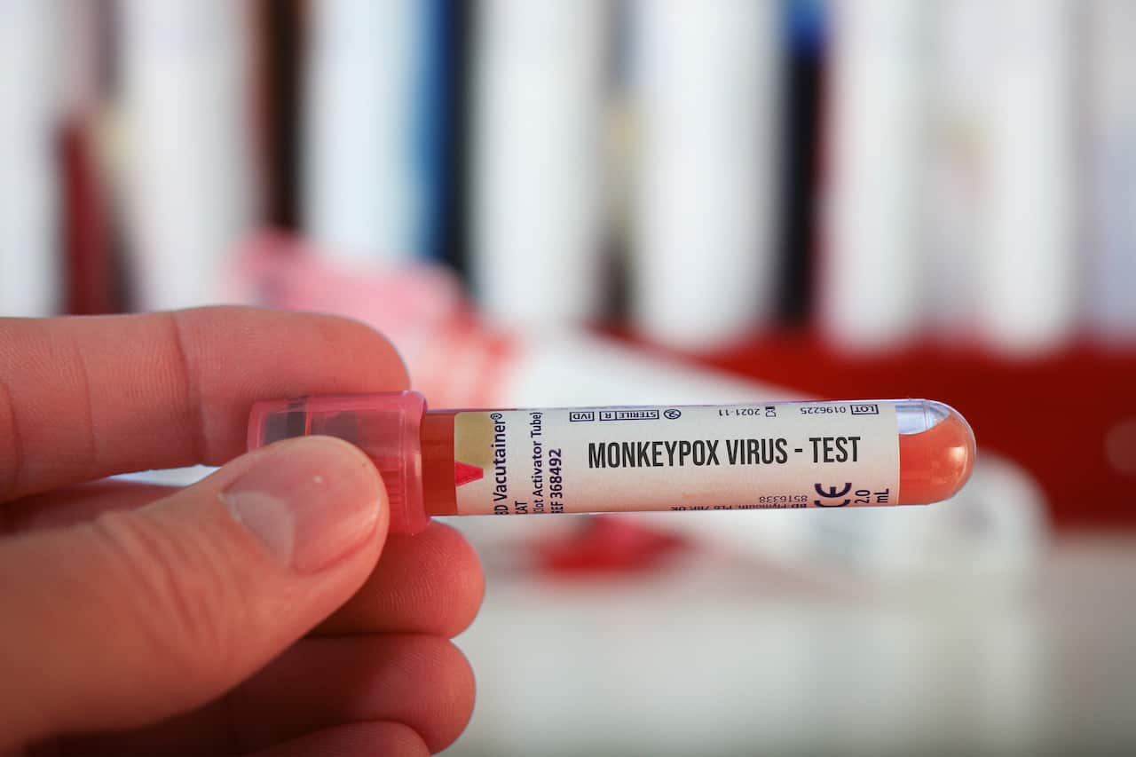 A vial with a label that reads "monkeypox virus - test".