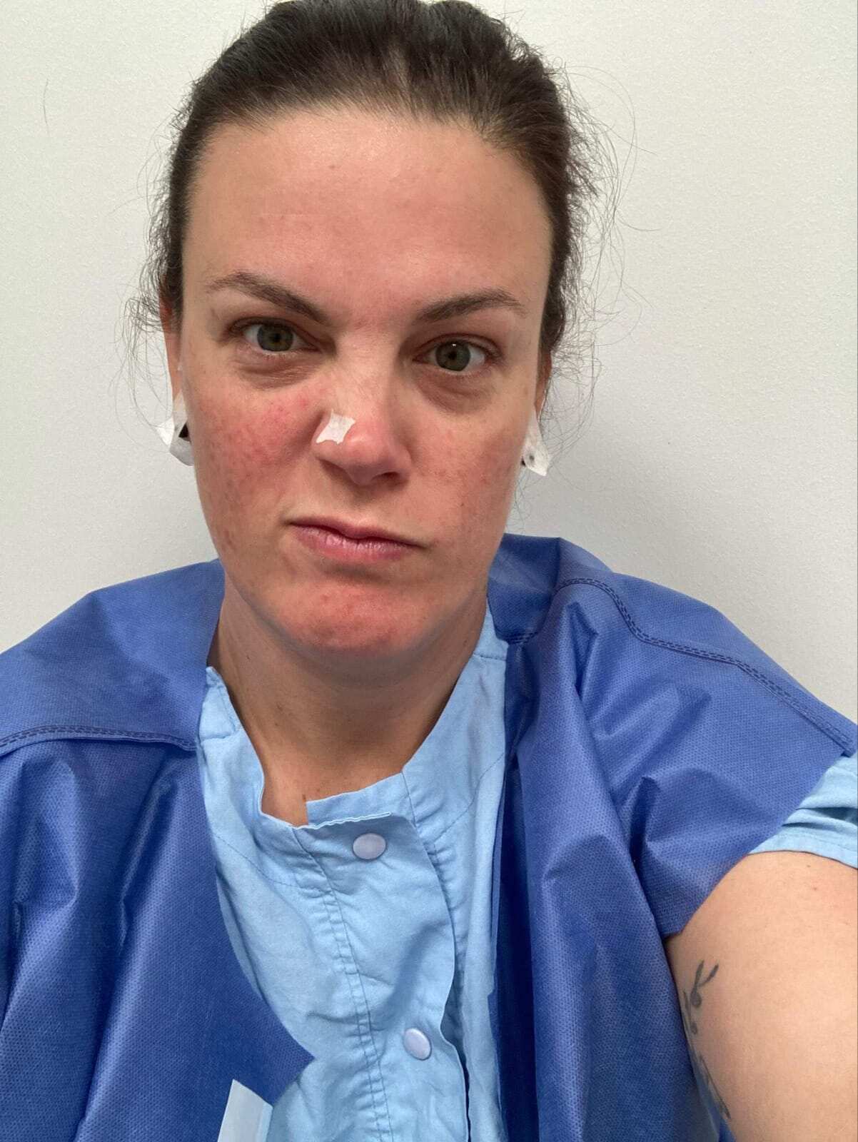 A selfie of Leigh-Anne Hodgetts after surgery 