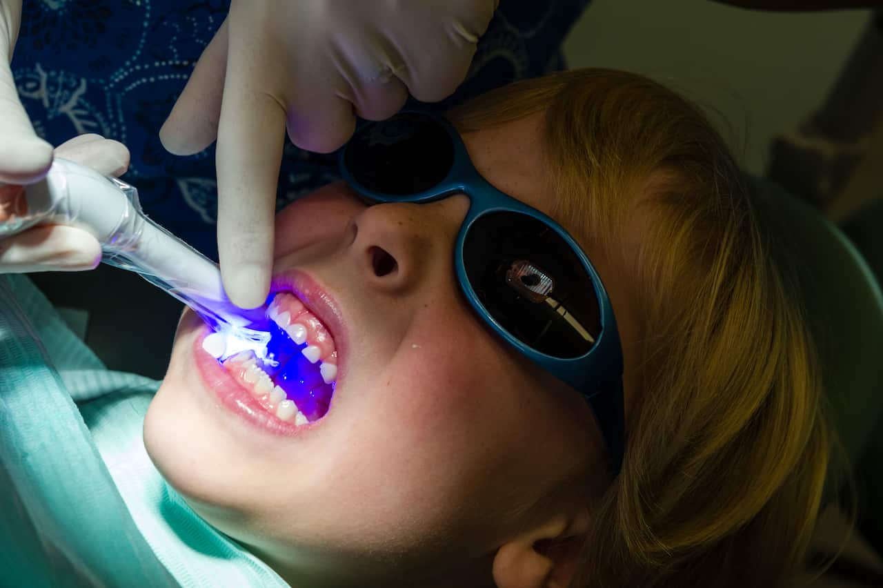 A dentist uses an ultra violet light to set composite fillings in the molars of a young boy.