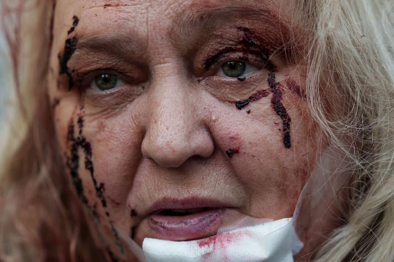 APTOPIX Russia Ukraine War